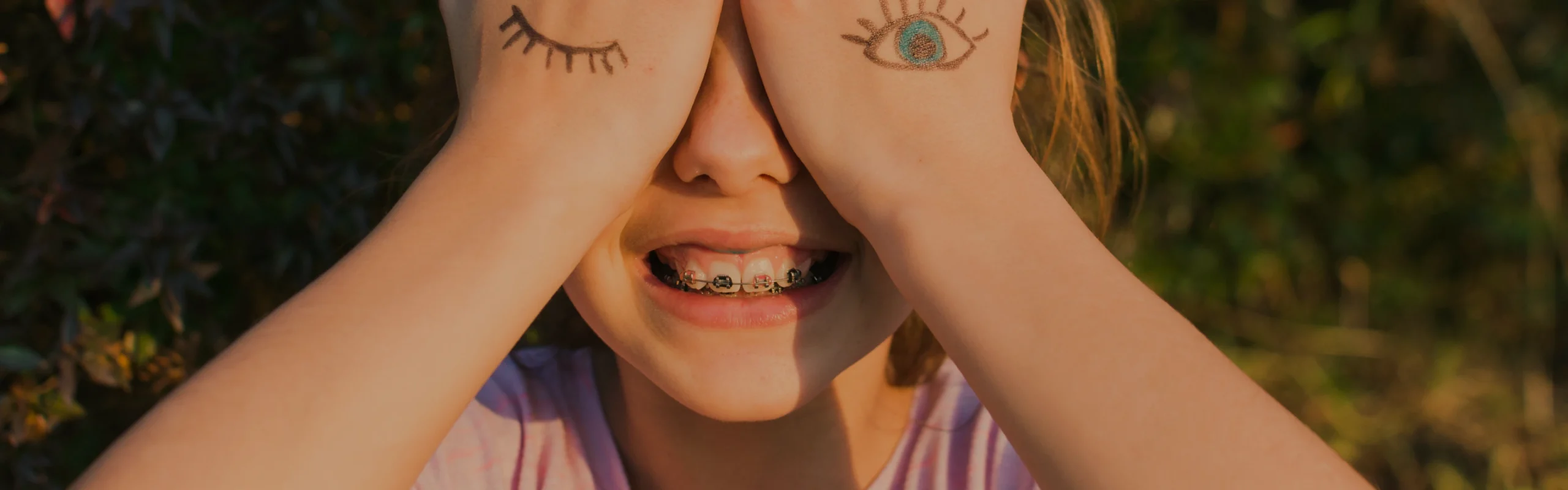 Brackets au cabinet du Dr Agathe Chevalier : orthodontie Châteaugiron