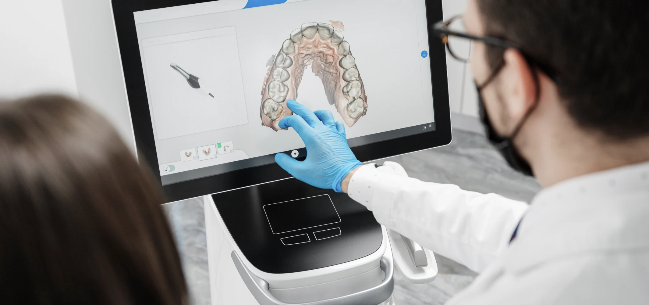 Empreinte optique au cabinet du Dr Agathe Chevalier : orthodontie Châteaugiron